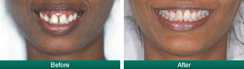 Smile Gallery