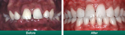 Smile Gallery