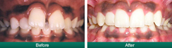 Smile Gallery