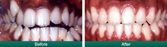 Smile Gallery