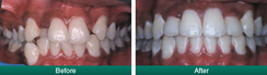 Smile Gallery