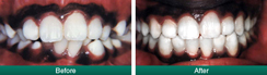 Smile Gallery
