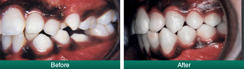Smile Gallery